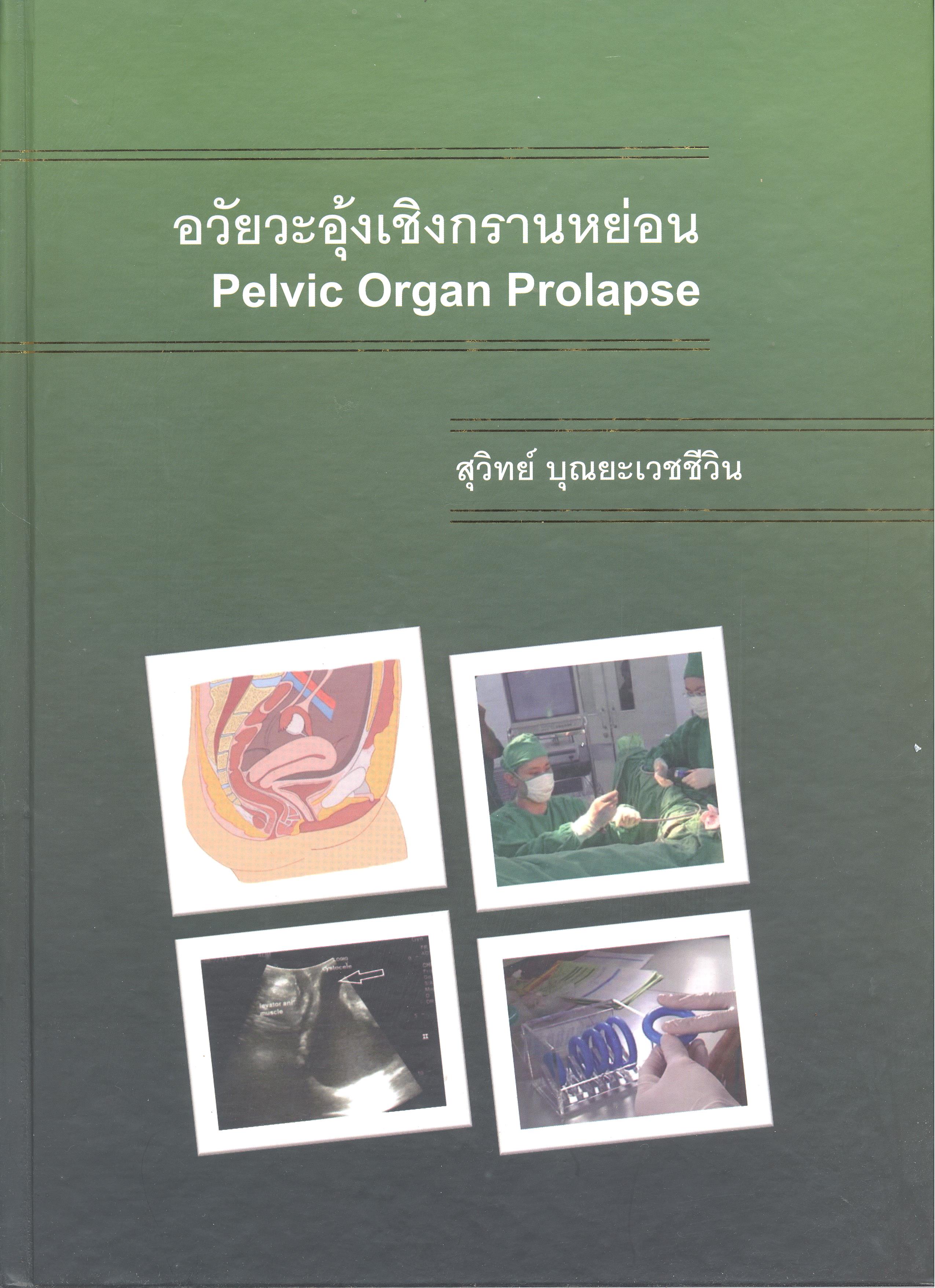 อวัยวะอุ้งเชิงกรานหย่อน