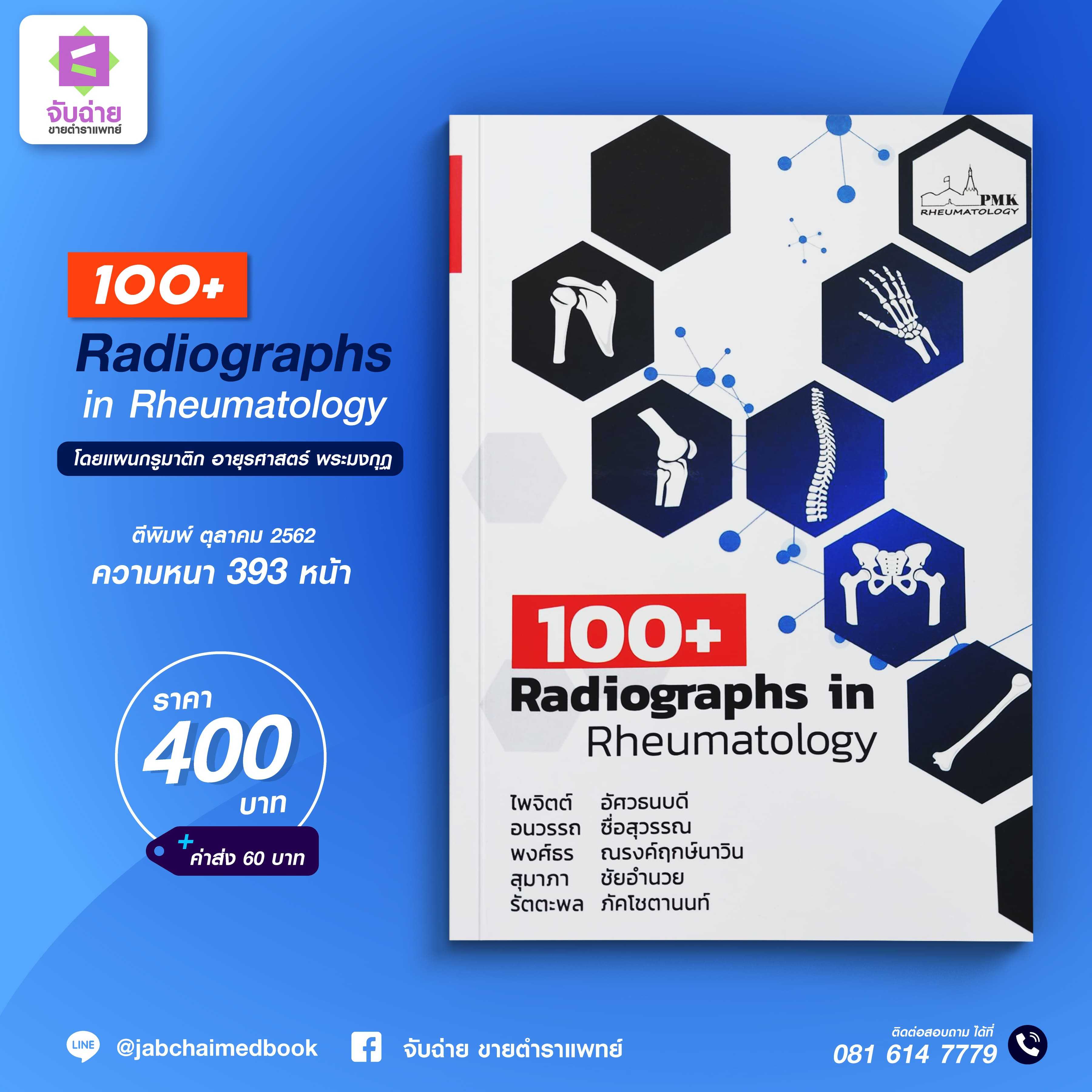 100+ Radiographs in rheumatology 